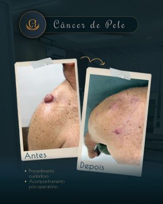 2 Posts para o Instagram (1080 x 1350 px) - 35