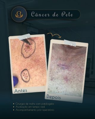 2 Posts para o Instagram (1080 x 1350 px) - 36