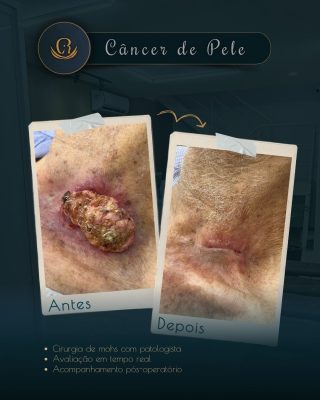 2 Posts para o Instagram (1080 x 1350 px) - 37