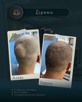 2 Posts para o Instagram (1080 x 1350 px) - 44